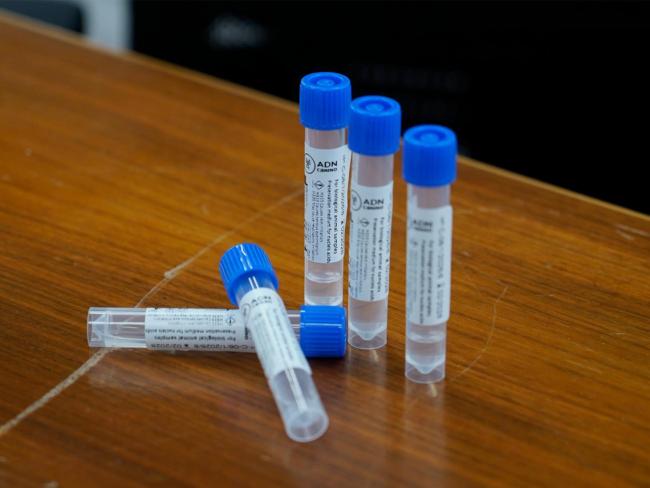 El Ayuntamiento implanta el ADN Canino-Censo Genético para reducir los excrementos de perros en las calles, siendo obligatorio realizar a todas estas mascotas un test de saliva, gratuito, hasta el 30 de septiembre
